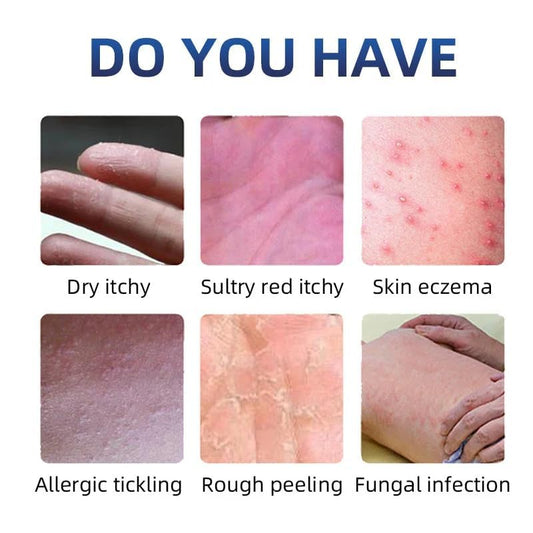 7263
